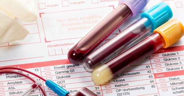 Аналіз крові на вірус папіломи людини